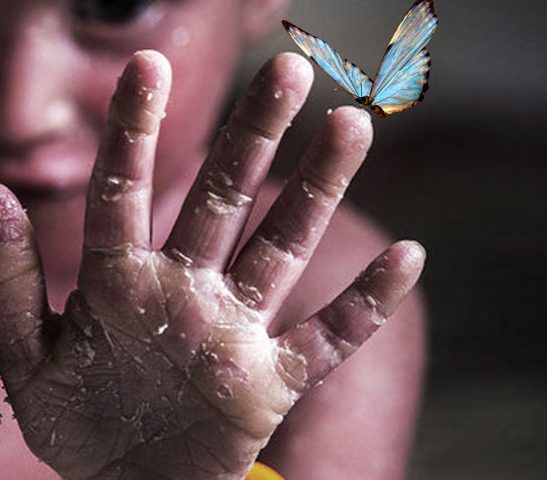 زخمی اما پر از امید زخمی اما پر از امید