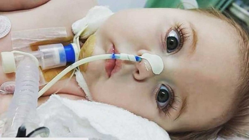 ازدواج فامیلی عامل اصلی درد بدون درمان &laquo;اس ام آ&raquo;