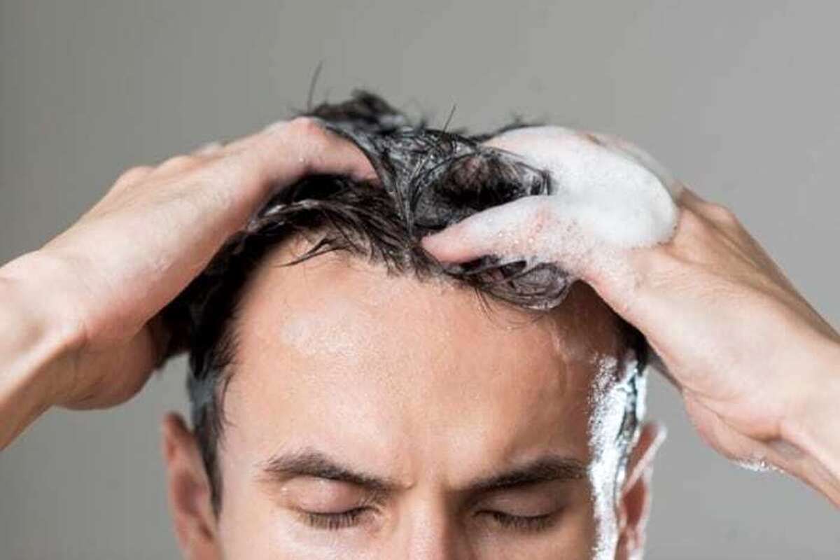 چرا موهای من همیشه چرب است؟ چرا موهای من همیشه چرب است؟
