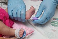 غربالگری موفقیت‌آمیز بیش از ۱۲ هزار نوزاد اردبیلی