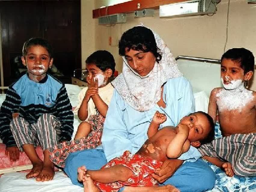 بمباران شیمیایی سردشت سند مظلومیت ملت ایران است بمباران شیمیایی سردشت سند مظلومیت ملت ایران است